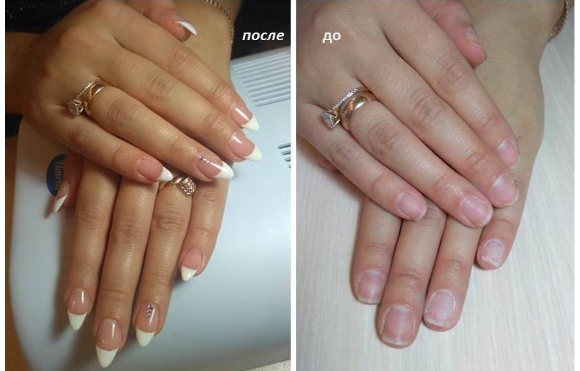 Фото ногтей до и после наращивания фото