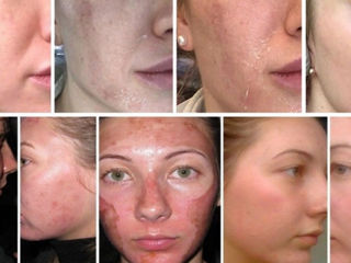 Cosmetolog, Toate tipurile de Servicii de Cosmetologie фото 3