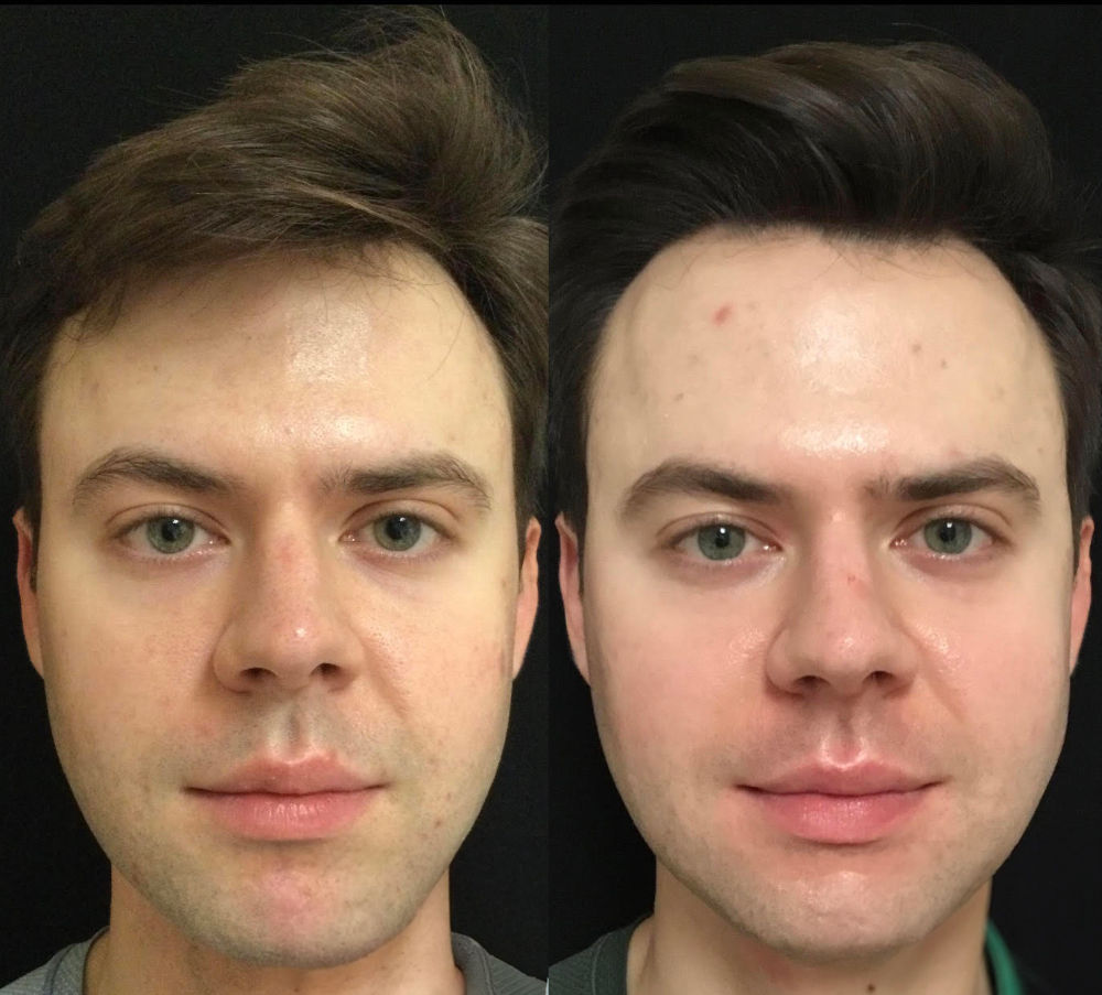 Prețuri pentru servicii de cosmetică în Chișinău! Salonul nostru de înfrumusețar Egoista foto 5