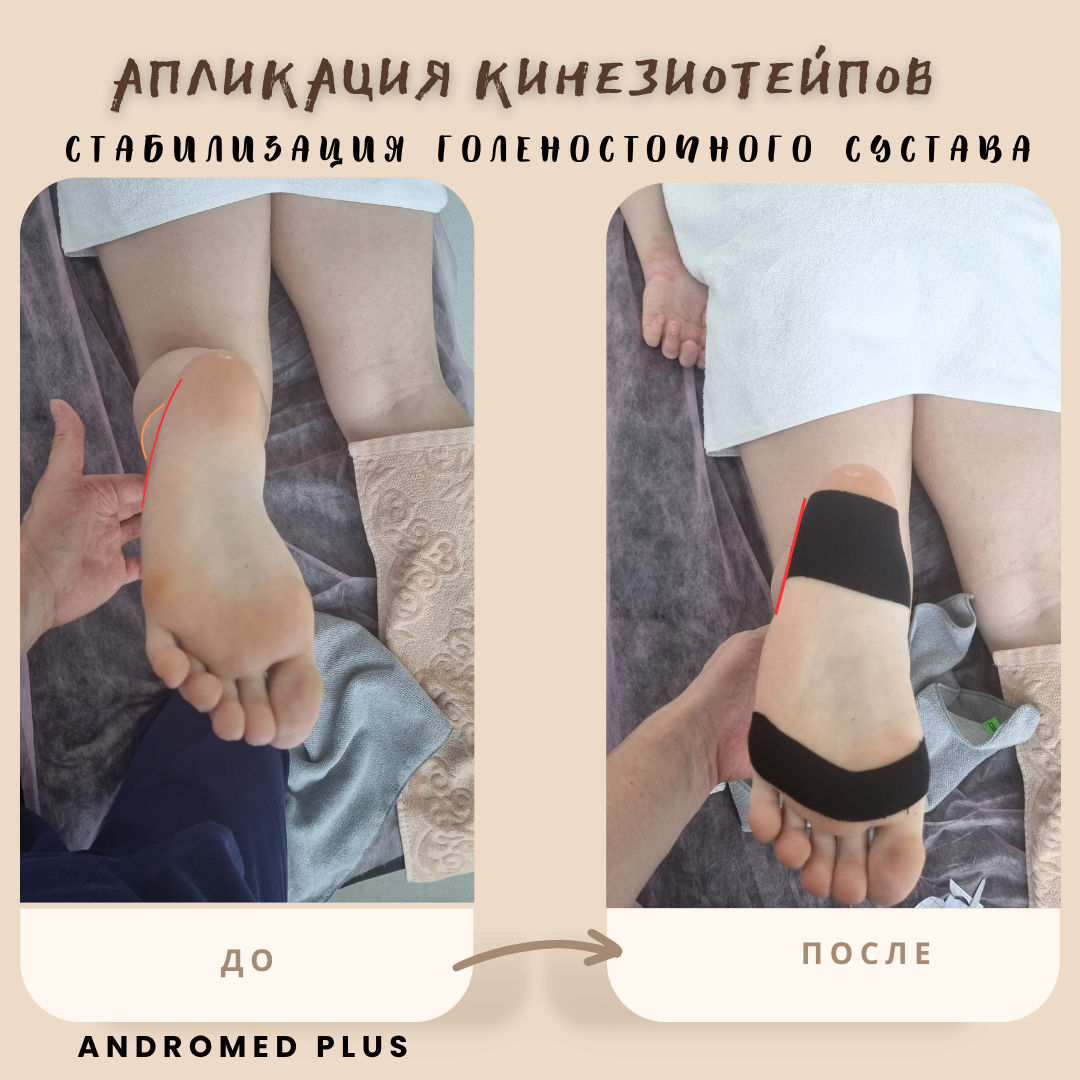 Кинетотерапия, массаж и реабилитация в Кишинёве – со скидкой 15% на первый приём! фото 1