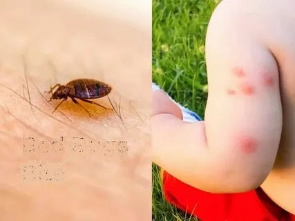 Exterminarea plosnita de pat , căpușă de pat , gândaci de bucataria , viespile foto 0