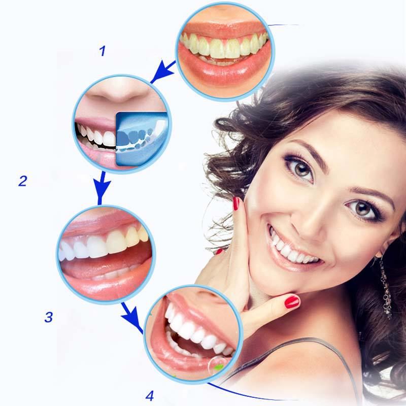 Отбеливающий набор Dental 360 white, карандаш для отбеливания зубов ...