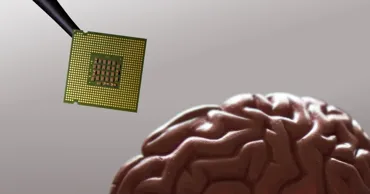 Un implant cerebral pentru ameliorarea durerii, dezvoltat și testat