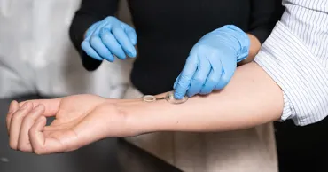 Ученые создали "умную" повязку для ран, выделяющую антибиотики при наличии бактерий