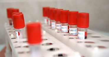 Инфекционист оценил влияние группы крови на восприимчивость к COVID-19.