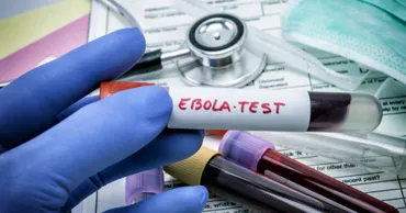 Primul caz de Ebola în Franța, confirmat la un medic revenit din Congo