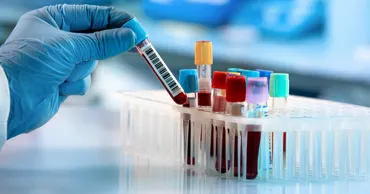 OMS a înregistrat un caz mortal cauzat de virusul Nipah în Bangladesh