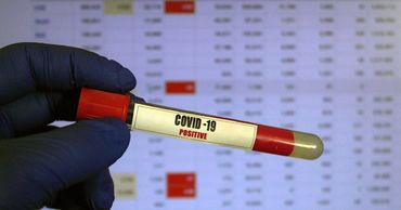В Молдове зарегистрировали 792 новых случая COVID-19.