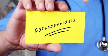 В США зафиксированы две первые смерти от циклоспороза