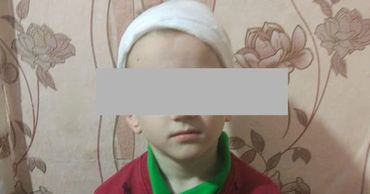 Женщина обвиняет детский сад в том, что у ребенка травма головы.