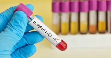 Учёные: Каждый восьмой случай рака в мире связан с инфекциями