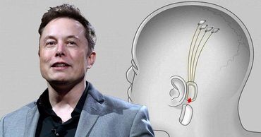 Компания Илона Маска Neuralink объявила о разработке мозговых имплантатов.