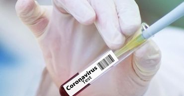 В Испании разработали тест на антитела к коронавирусу с точностью 98%.