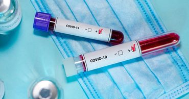 В Молдове зарегистрировали 252 новых случая COVID-19.