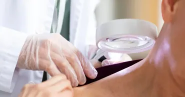 Premieră medicală la Institutul Oncologic: O nouă tehnică pentru tratarea cancerului de piele