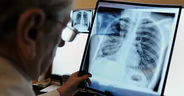 Власти планируют к 2030 году сократить заболеваемость туберкулёзом на 80%