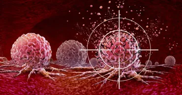 Cercetătorii au dezvoltat o imunoterapie care distruge cancerul metastatic