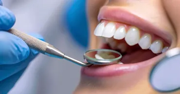 Cercetătorii au creat primul gel pentru refacerea smalțului dentar: Conceput să protejeze împotriva cariilor