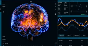 Cercetătorii au identificat neuronii care controlează nevoia de somn