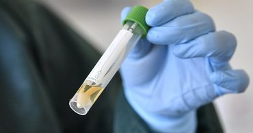 Красносельский поддержал выборочное COVID-тестирование работников торговли и сферы услуг.