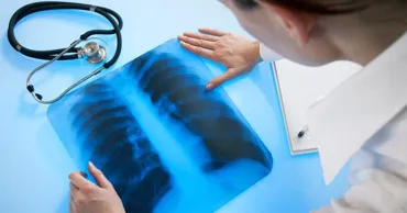 Mortalitatea cauzată de tuberculoză a scăzut în Moldova