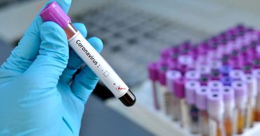 В Молдове зарегистрировали 174 новых случая COVID-19