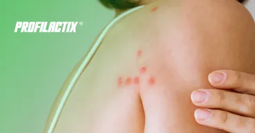 Profilactix: Тысячи молдаван лечатся от чесотки зря. В чём настоящая причина? Ⓟ