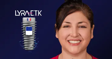 Dentus: 5 причин выбрать европейские зубные импланты Lyra Ⓟ