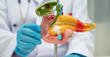 Pancreasul gras, o afecțiune tot mai frecventă. Medicii avertizează asupra riscurilor