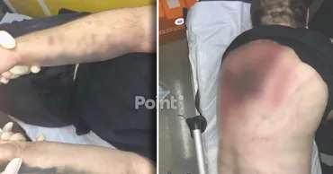 Жестокое нападение на студента в Кишинёве: появились шокирующие фото полученных травм