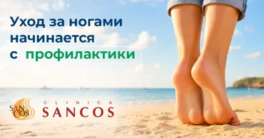 Sancos: Начните лето со здоровых стоп - зачем нужен подолог Ⓟ