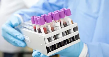 Studiu: Grupa sanguină influențează probabilitatea unui accident vascular cerebral prematur