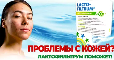 Лактофильтрум: Прыщи у подростка - почему кожа страдает и как ей помочь изнутри Ⓟ