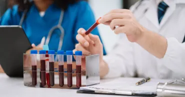 Studiu: Nivelul de dioxid de carbon din sângele oamenilor crește constant