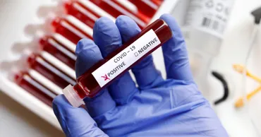Republica Moldova a înregistrat un număr scăzut de infectări cu COVID-19