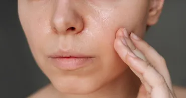 Ученые: Глобальное потепление лишает людей здоровой кожи