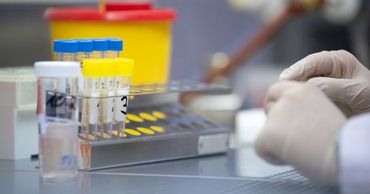 У 4 жителей Гагаузии подозревают COVID-19.