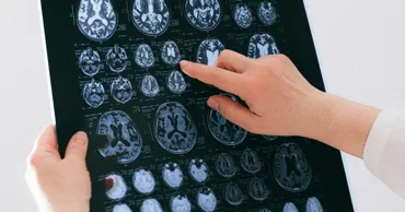 Premieră la Londra: O operație de creier asistată de AI a salvat vederea unui bărbat