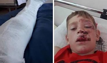В Штефан-Водэ водитель сбил ребенка и отвез его домой.