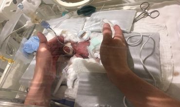 В Японии выпишут из больницы младенца, родившегося с весом 258 граммов.