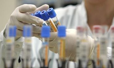 В России предлагают $31,5 тысячу посмертно за испытание вакцины.