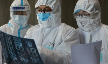У бессимптомно болевших COVID-19 нашли поражения легких.