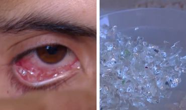 Плачущая кристаллами армянская девушка привела врачей в замешательство.