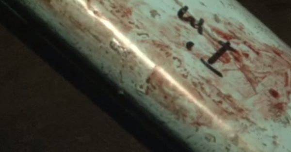 A ajuns la spital plin de sânge, după ce soţia şi-a pierdut cumpătul