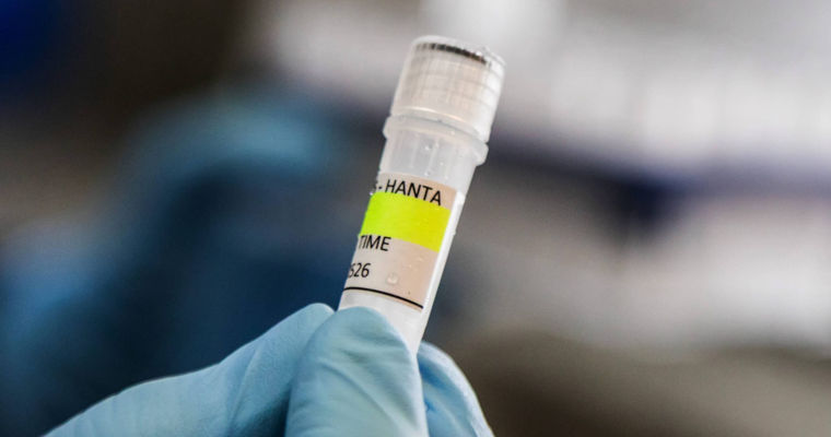 Вакцину против хантавируса разрабатывают годами из-за нехватки финансирования.