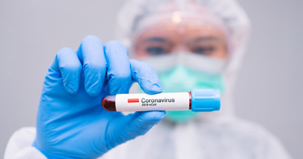 В Молдове зарегистрировали 952 новых случая COVID-19.