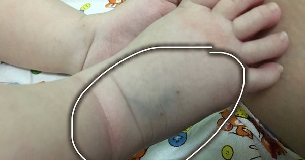 По мнению родительницы, малыш оказался в больнице по той же халатности врачей этого же учреждения, которые не выявили вовремя болезнь.