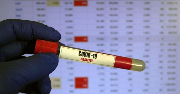 В Молдове зарегистрировали 792 новых случая COVID-19.