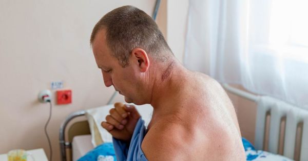 Бельчанин, на которого упало дерево, сам добирался до больницы.