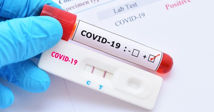 За неделю в Молдове зарегистрировали 378 случаев COVID-19: четыре человека скончались.